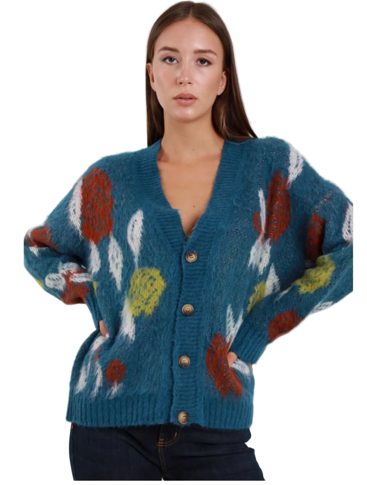 Cardigan Over Susy Mix